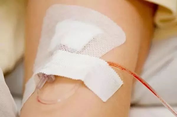 【分享】静脉输液与输血的最全安全控制技巧